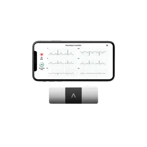 AliveCor KardiaMobile 1's